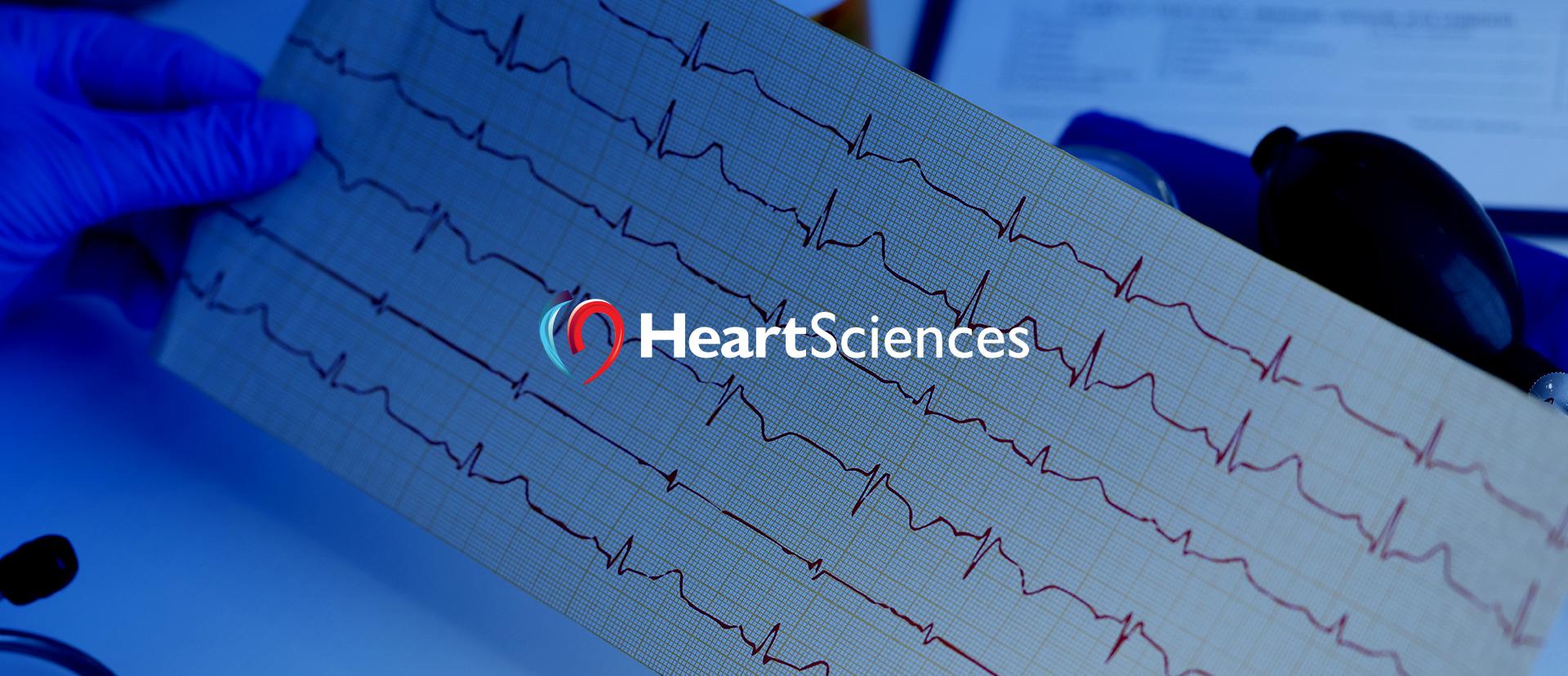 IPO Heart Test Laboratories: штучний інтелект у ЕКГ